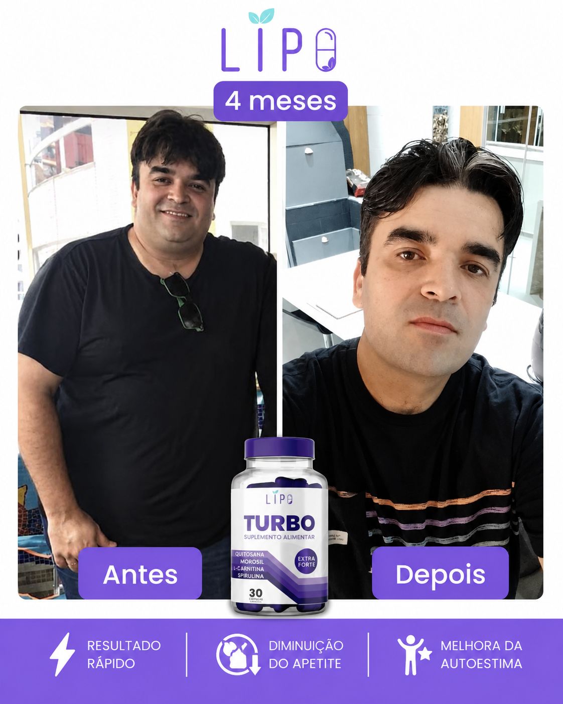 Antes e depois Rafael
