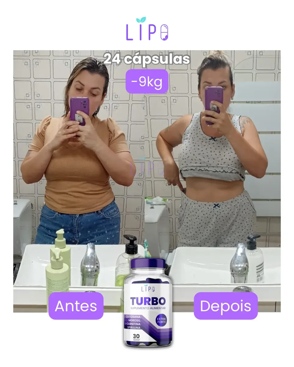 Antes e depois Cliente Lipo